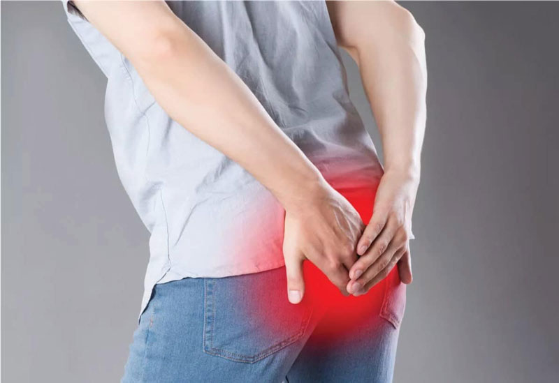 Dấu hiệu nhận biết mắc trĩ và cách xử lý cực chuẩn từ chuyên gia