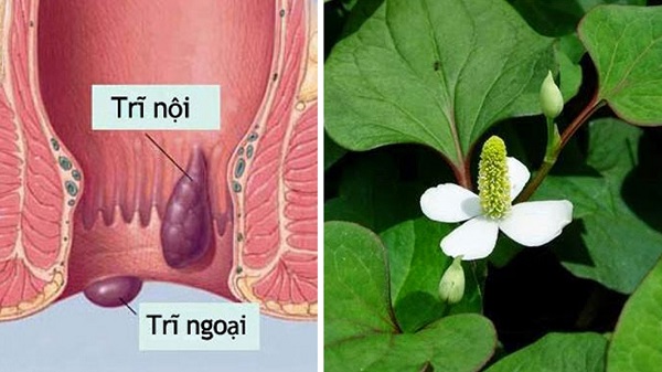 Mẹo dân gian co búi trĩ bằng rau diếp cá tại nhà